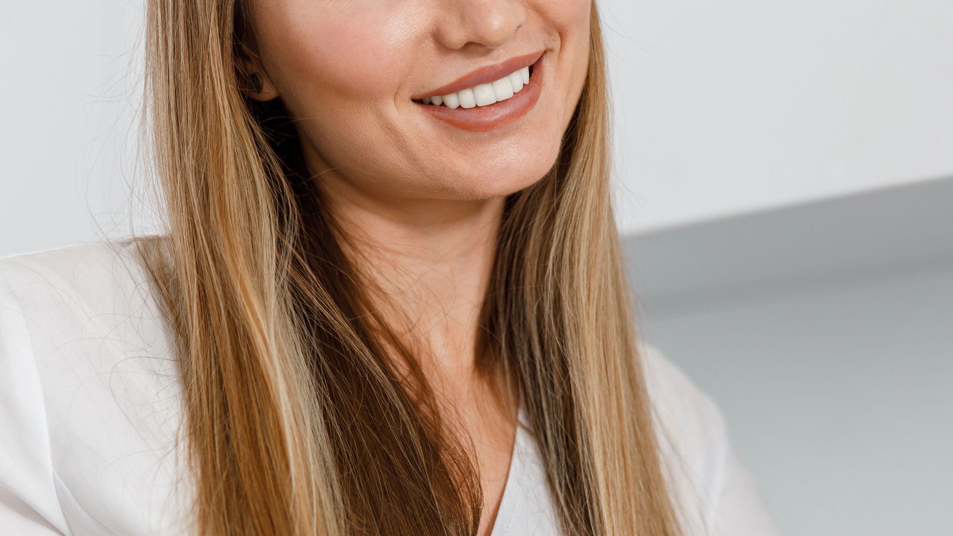 Sorriso hollywoodiano: esempio di faccette dentali per ottenere un sorriso perfetto.