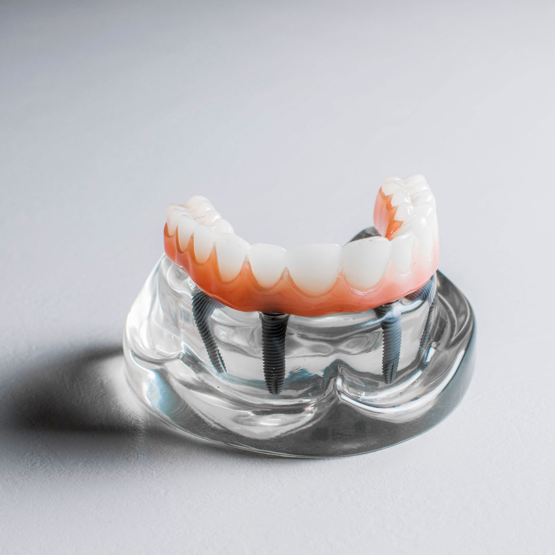 Un modello di impianto dentale in una ciotola di vetro.