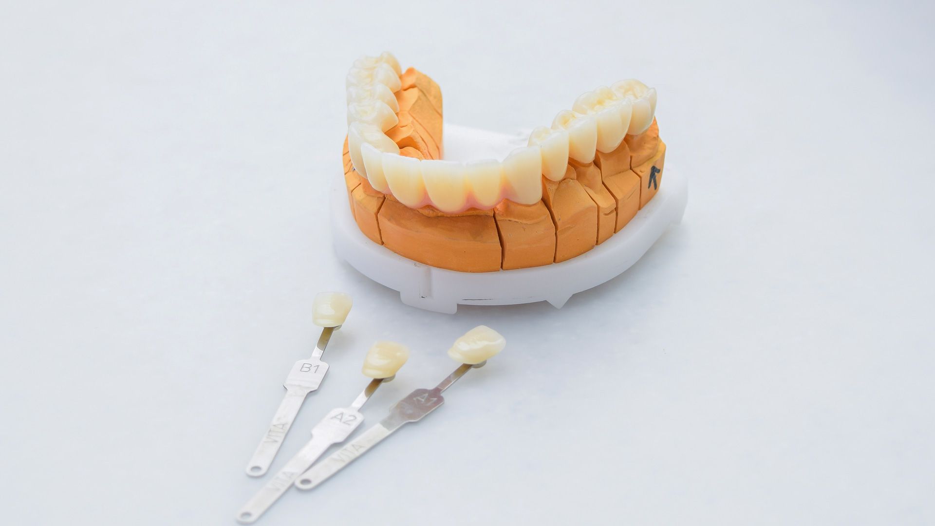 Un modello dei denti di una persona e tre tonalità di denti su una superficie bianca.