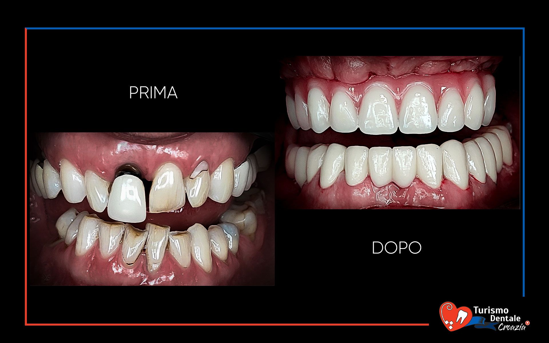 Allon4, Allon5, Allon6 prima e dopo esempio #2