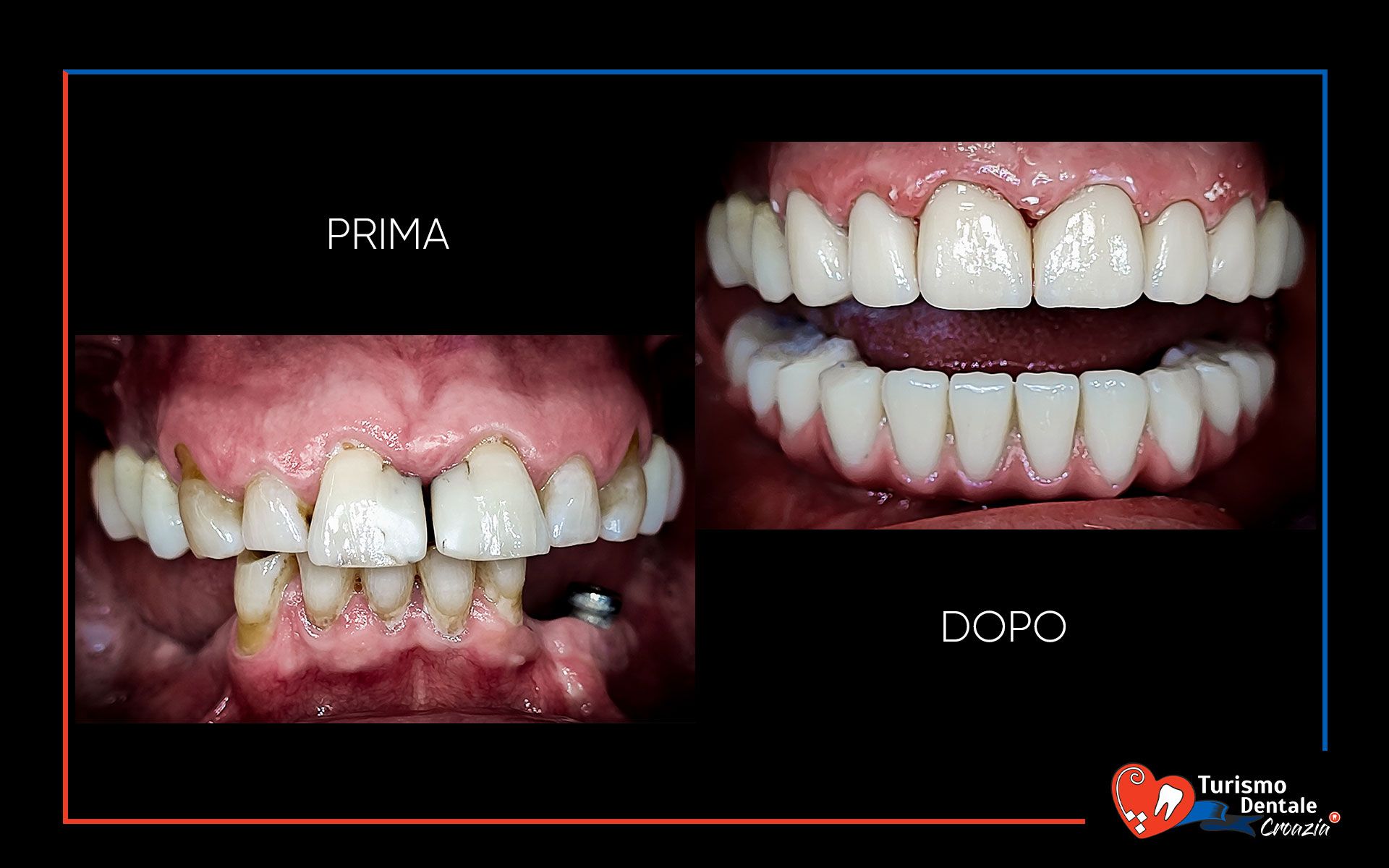 Allon4, Allon5, Allon6 prima e dopo esempio #8