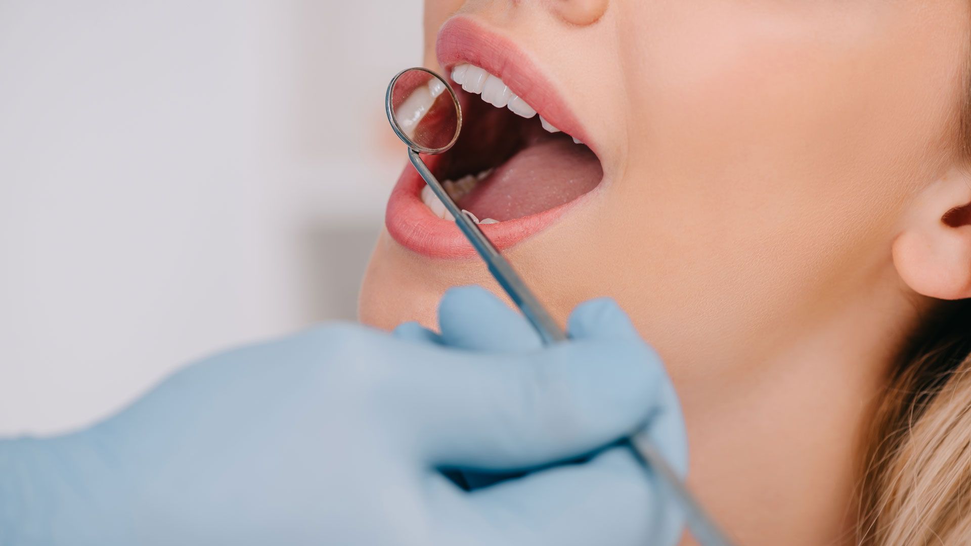 quanto costa una corona dentale in turismo dentale croazia