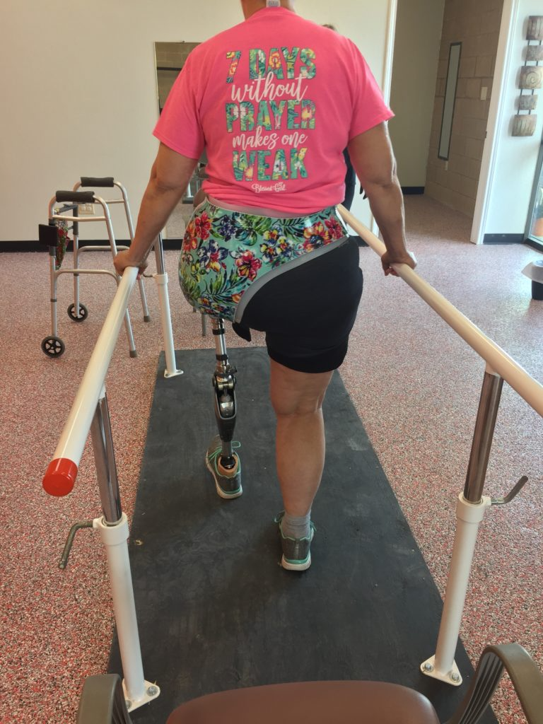 A woman with a prosthetic leg is walking on a treadmill.