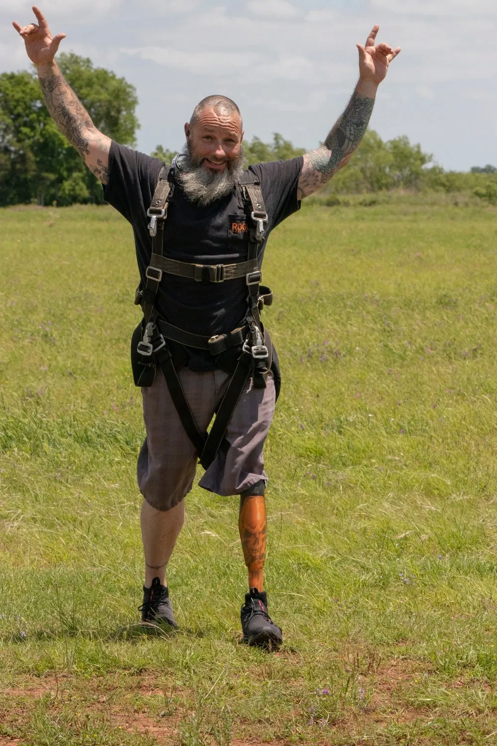 A man with a prosthetic leg is standing in a field with his arms in the air.