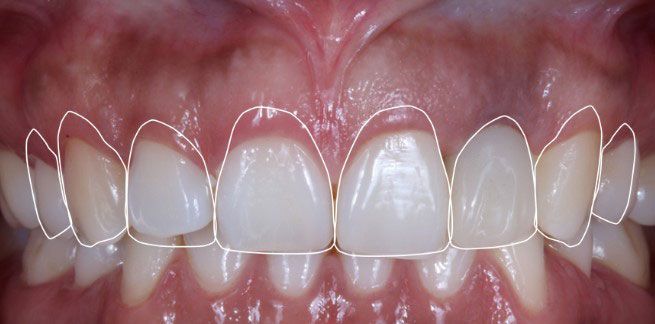 Dra. Angélica Robelo