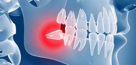 Dra. Angélica Robelo