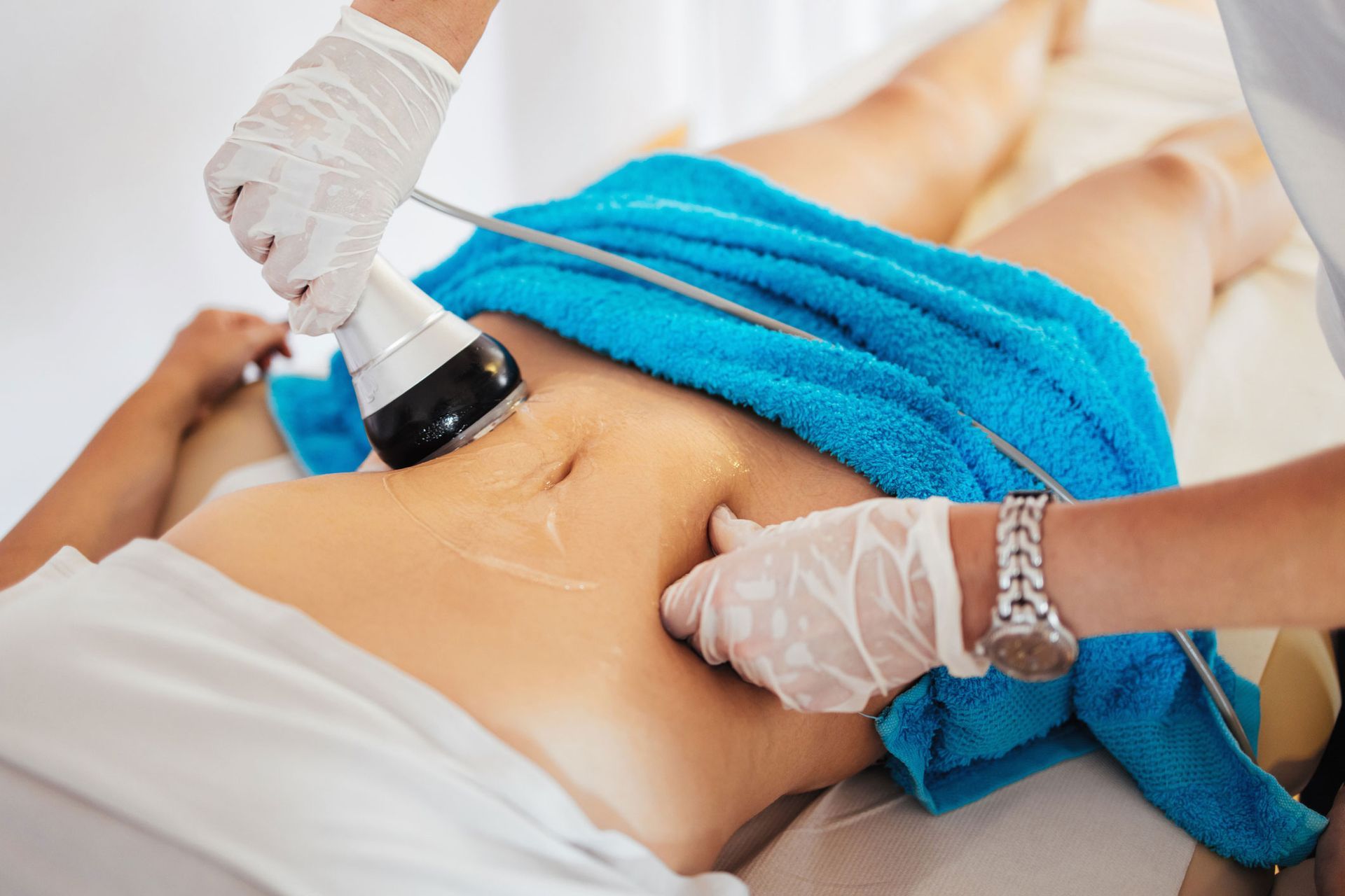 A person receiving radio frequency treatment on their abdomen; blue towel, white gloves, close-up shot.