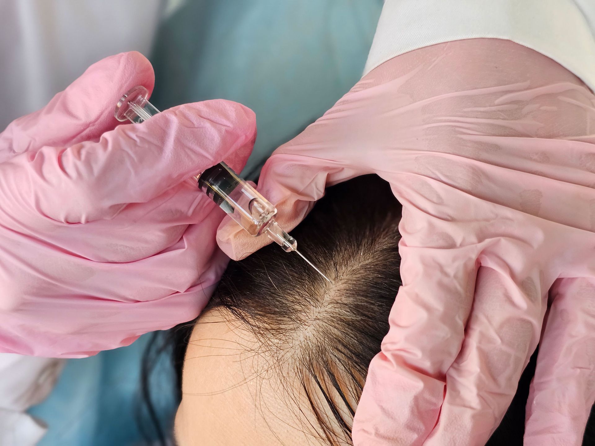 Person receiving injection to scalp. Pink-gloved hands hold syringe near head with visible hair thinning.