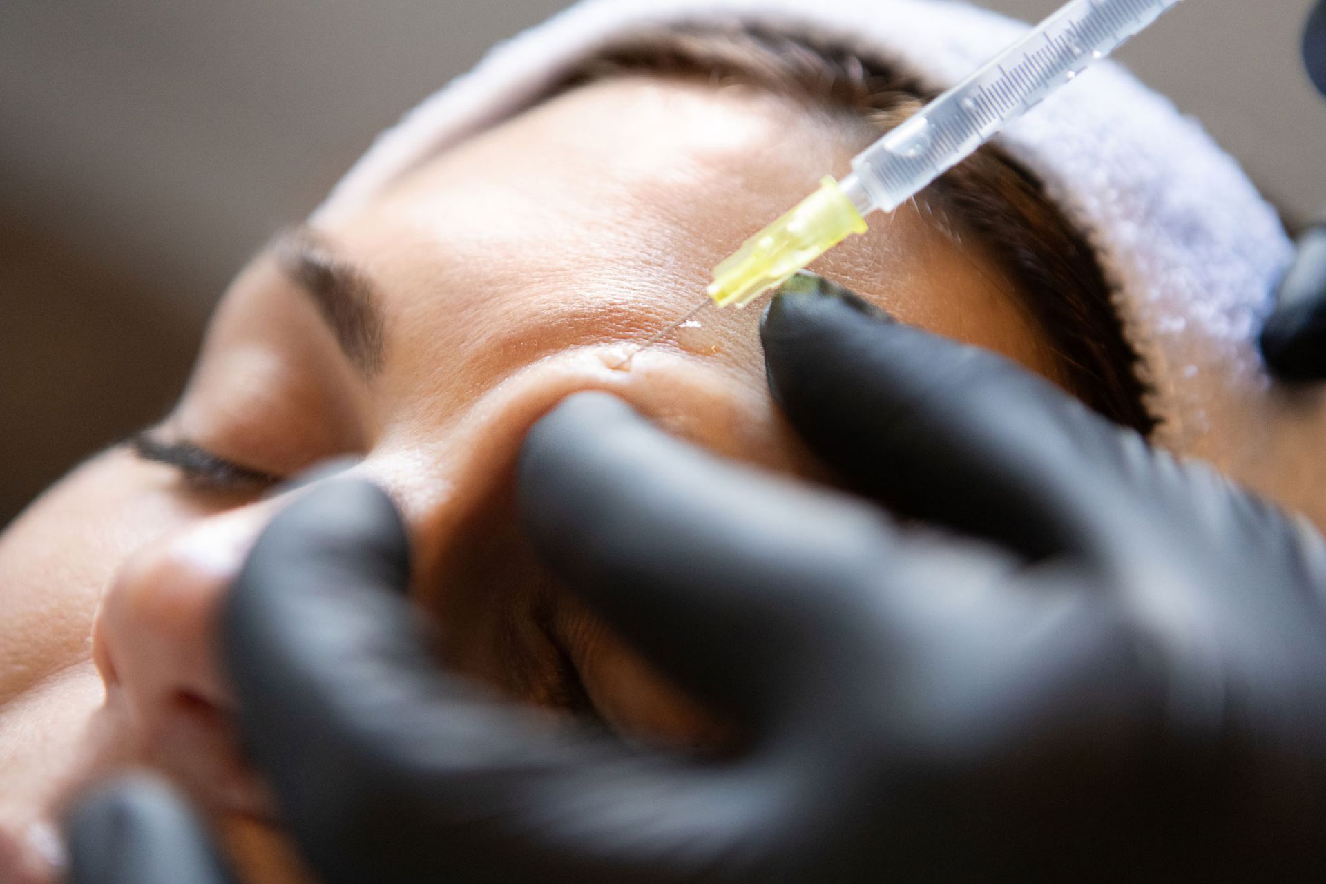 Close-up of a person receiving a forehead injection with a syringe.