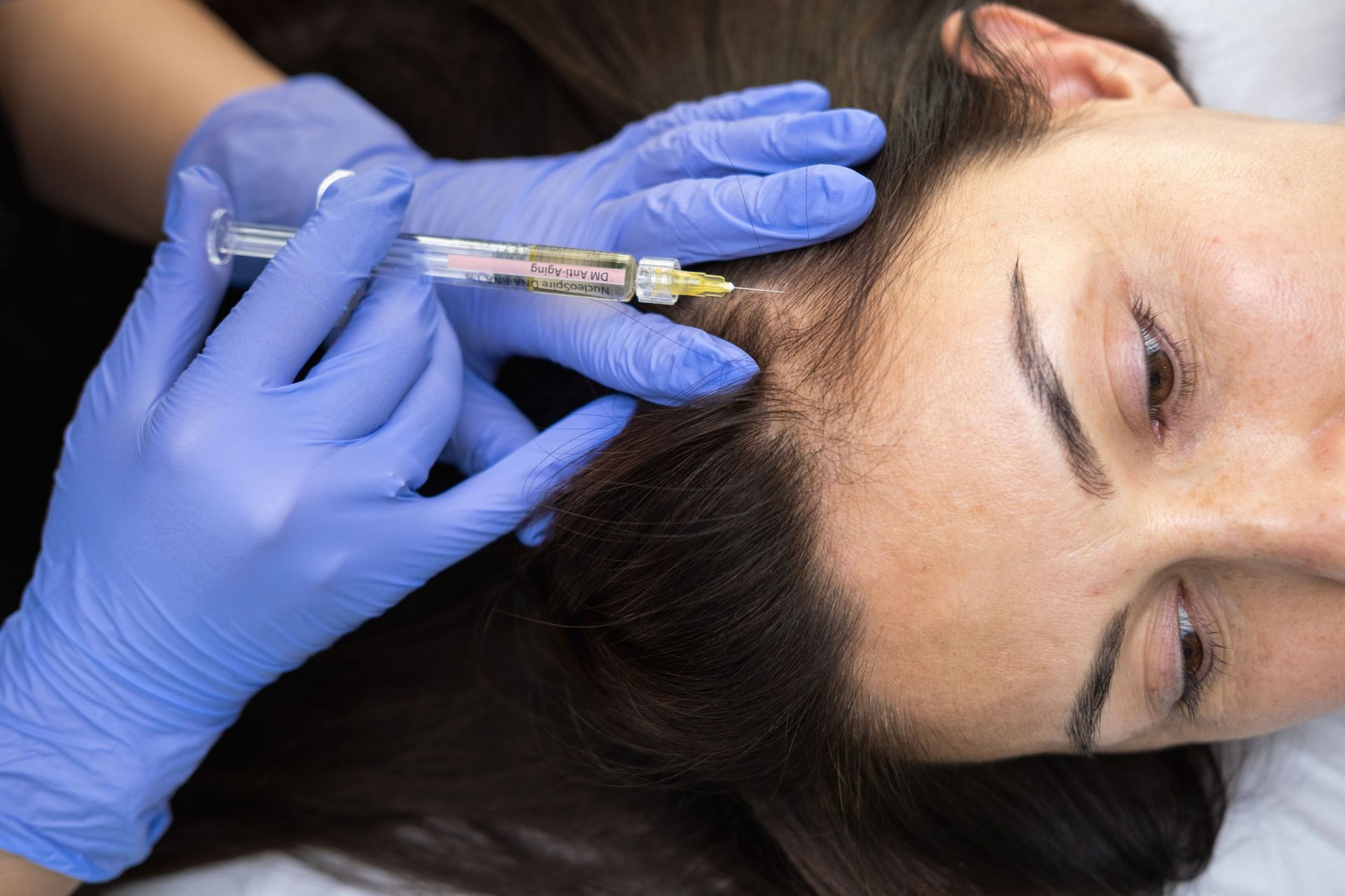 Person receiving an injection in their scalp by a gloved hand. Syringe and blue gloves visible.