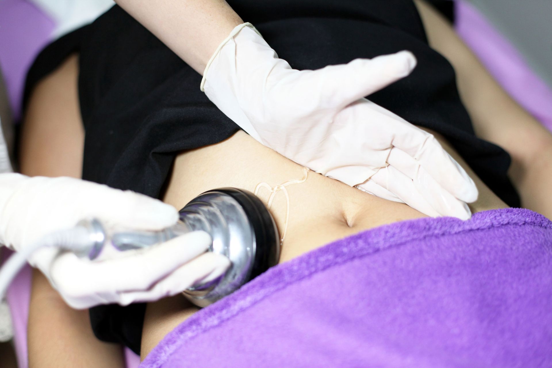 Hands wearing gloves using a device on a person's abdomen, on a treatment table.