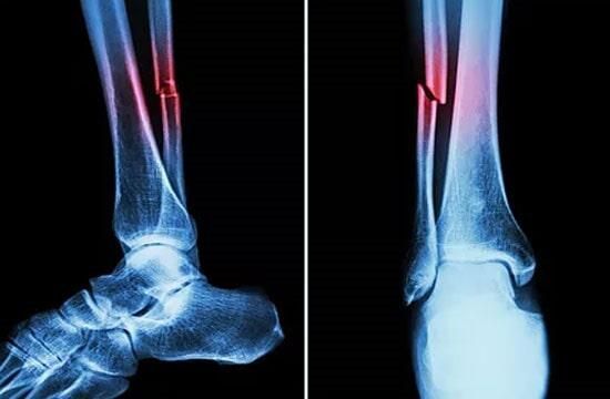 DR JAVIER BAIDON ROMANO - técnicas modernas de mínima invasión