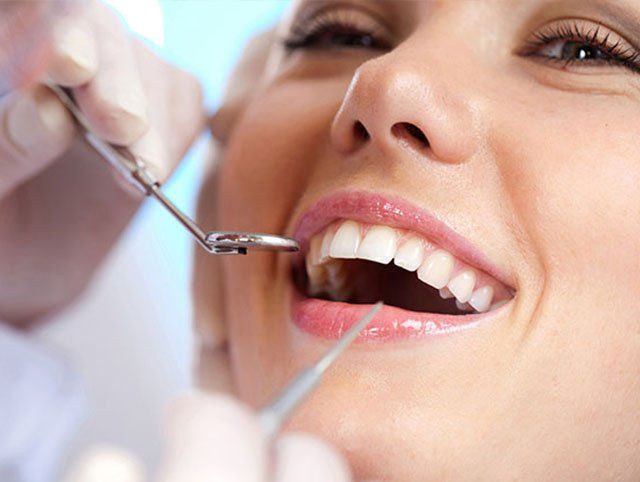 Teeth Whitening — Teeth Whitening in San Diego, CA