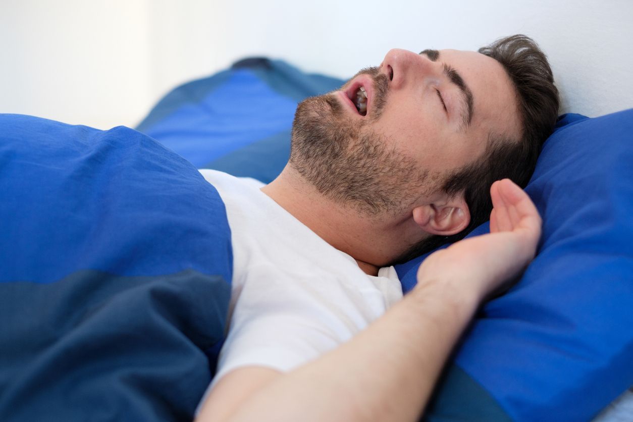 A man is sleeping in a bed with his mouth open.