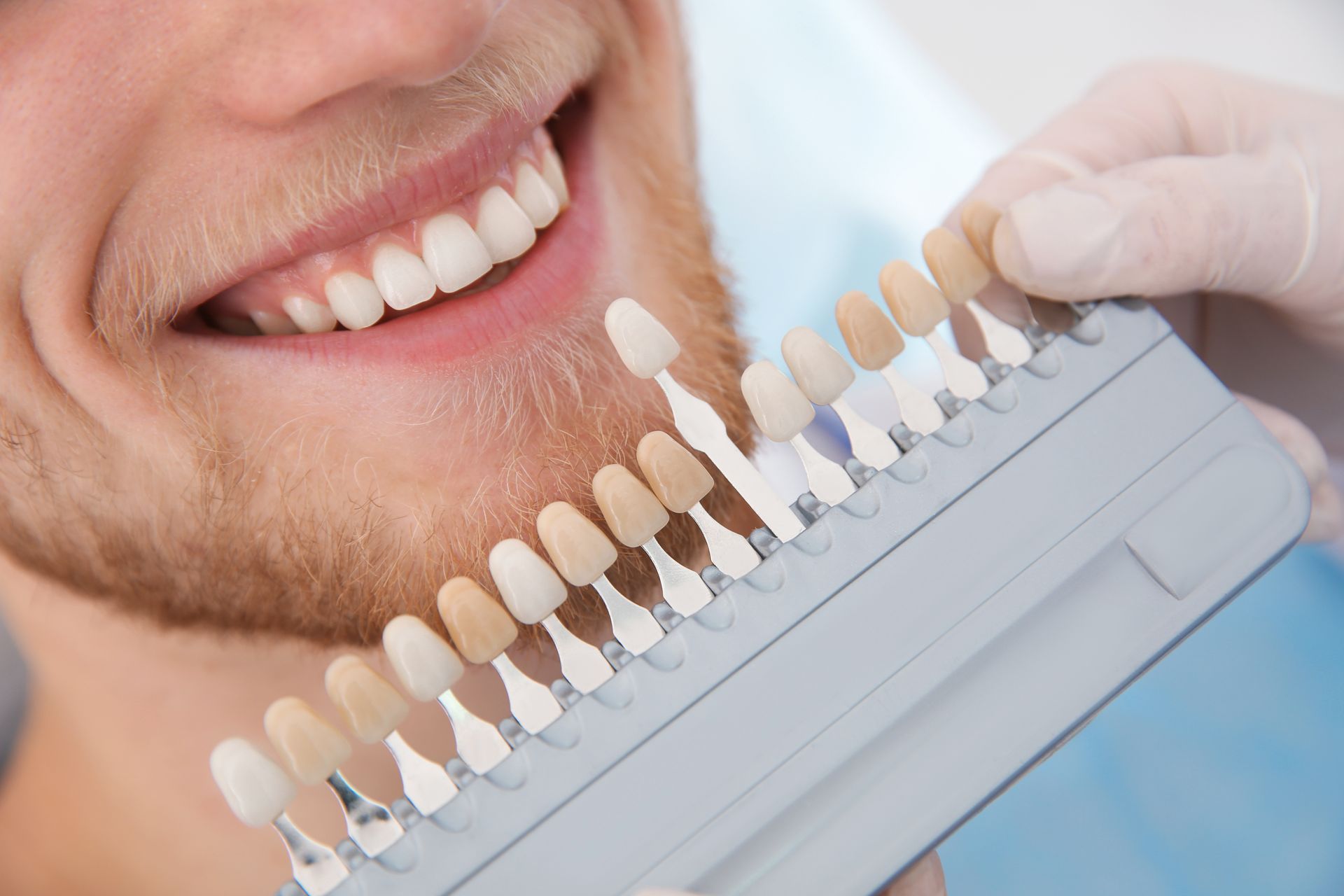 A person smiles while a dentist holds a shade guide to match their tooth color.