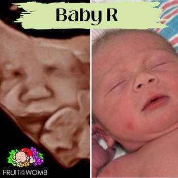 an ultrasound of a baby and a picture of a baby