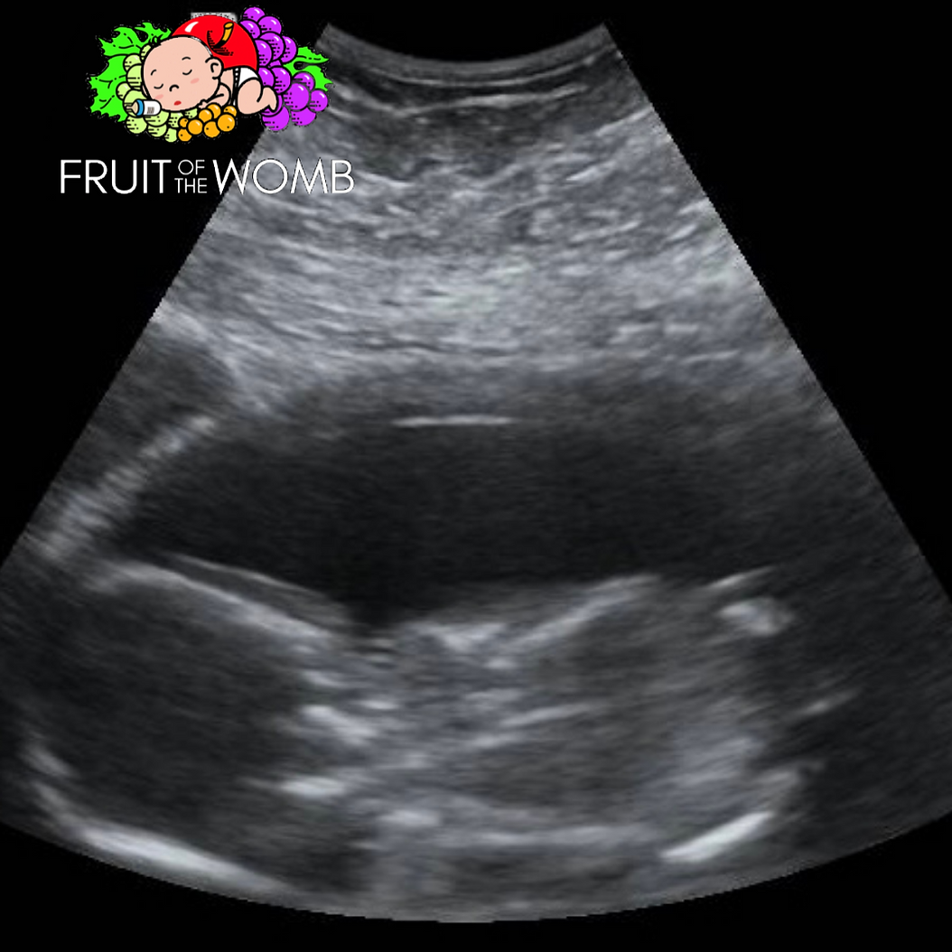 an ultrasound of a baby with a fruit of the womb logo