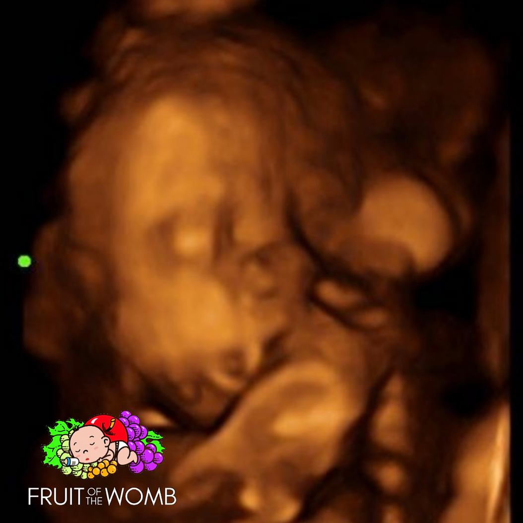 an ultrasound of a baby with the words fruit of the womb below it