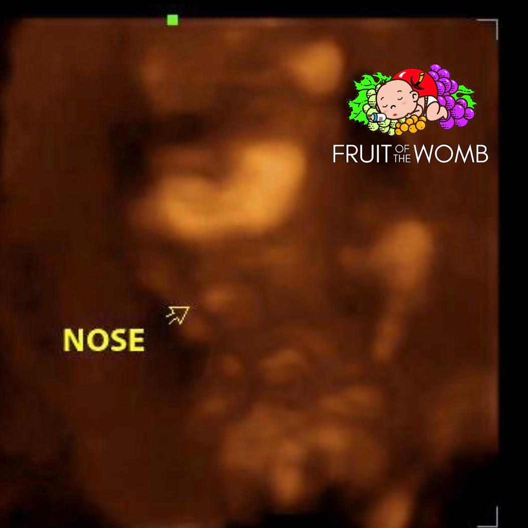 a picture of a baby 's nose with a fruit of the womb logo