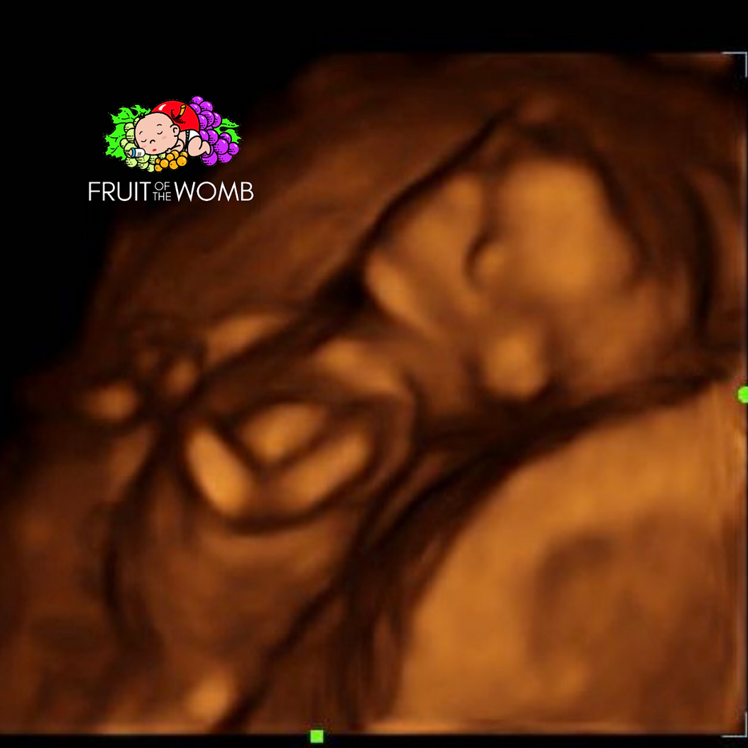 an ultrasound of a baby with the words fruitswome on the bottom
