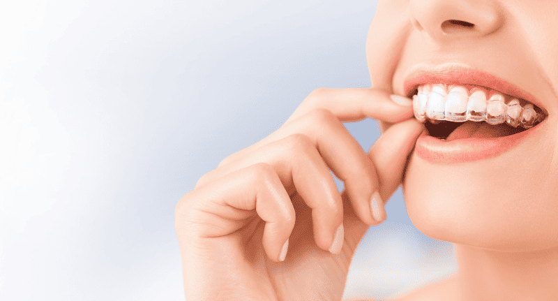 Patient taking out upper Invisalign tray.