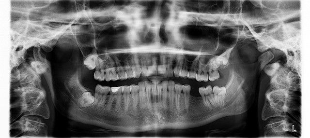 x-ray-961977_640