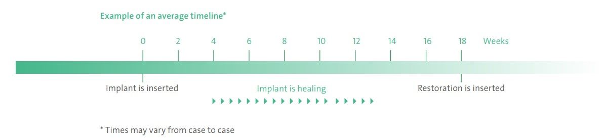 Pannal Dental Clinic, dental implants in Harrogate 