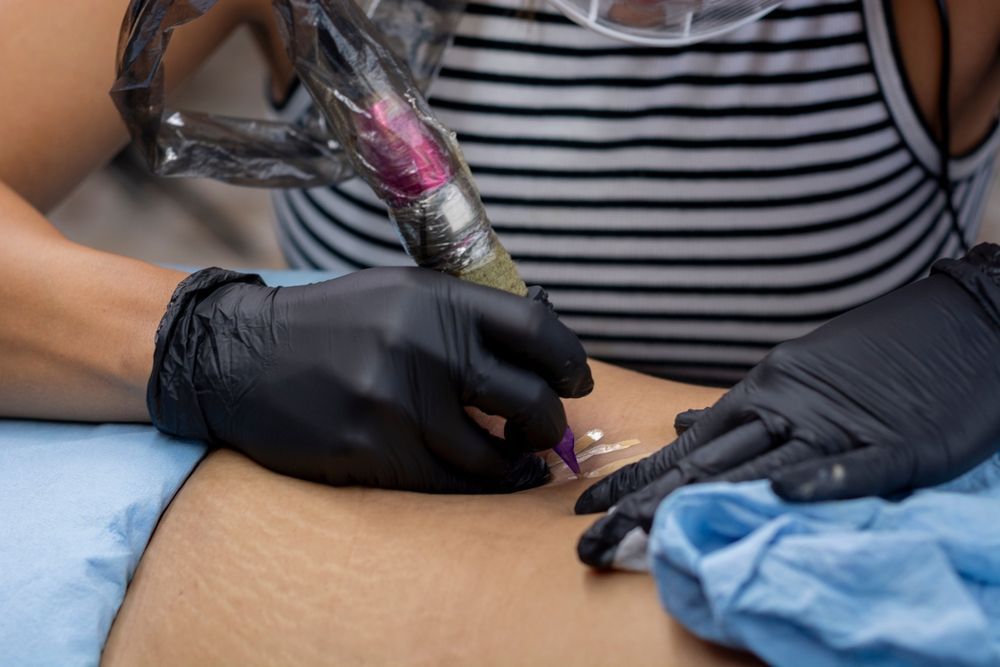 A woman is getting a tattoo on her stomach.