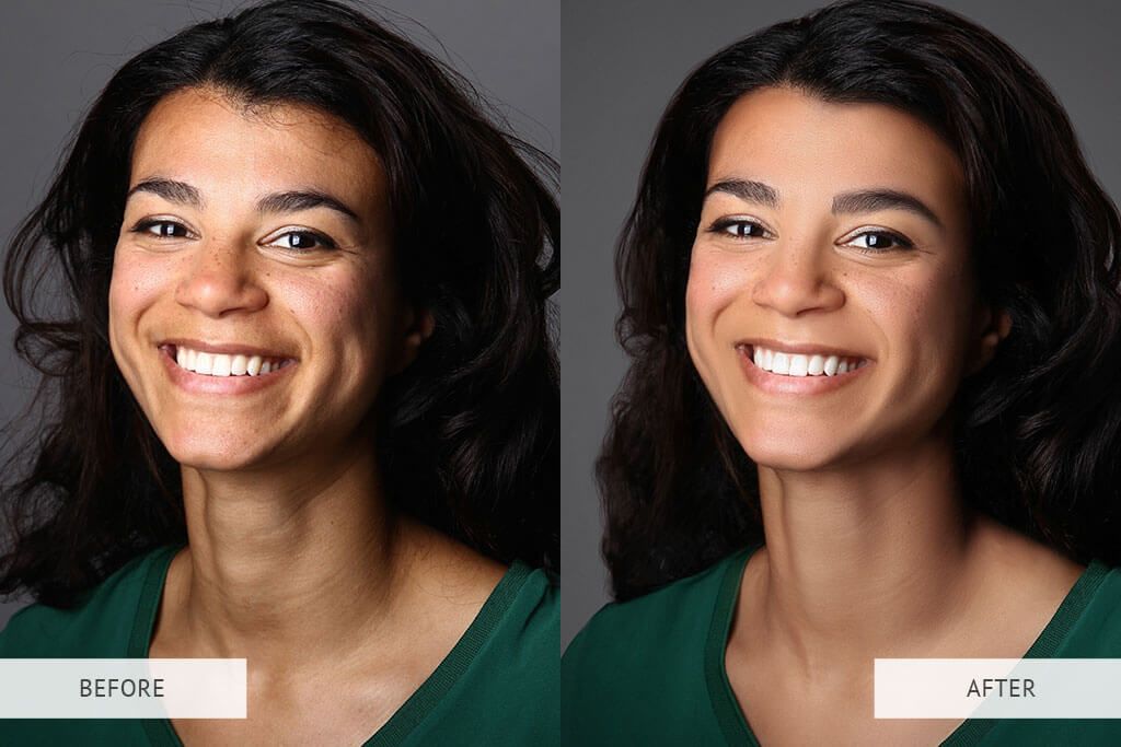 A before and after photo of a woman smiling.