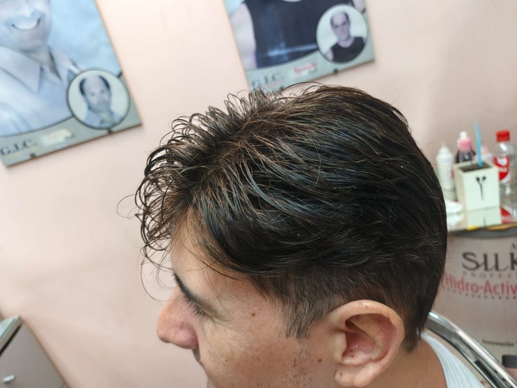 Un hombre de cabello oscuro visto de perfil, con carteles de un salón de belleza que muestran los resultados de tratamientos para la caída del cabello al fondo.