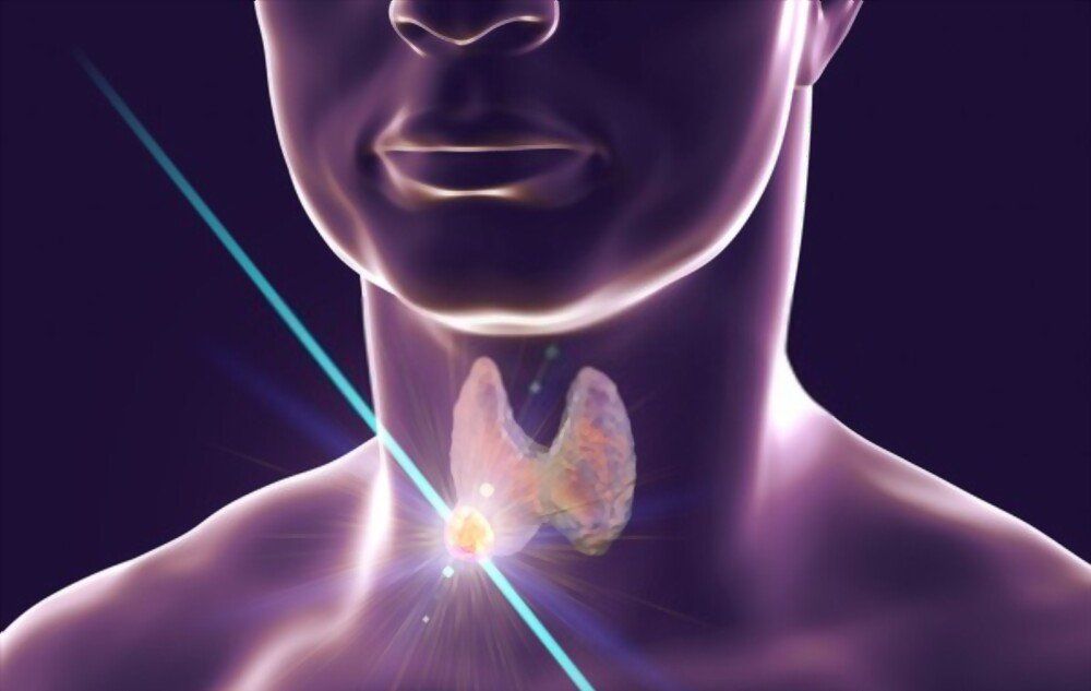 Como é realizada a ablação de tireoide?