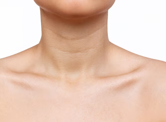 Ablação de tireoide por radiofrequência em São Paulo: Vantagens estéticas e funcionais