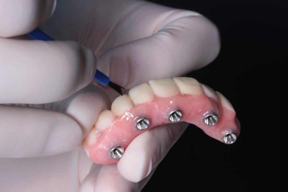 Dentist Working On Dentures — Dentistry Services in Cairns, QLD