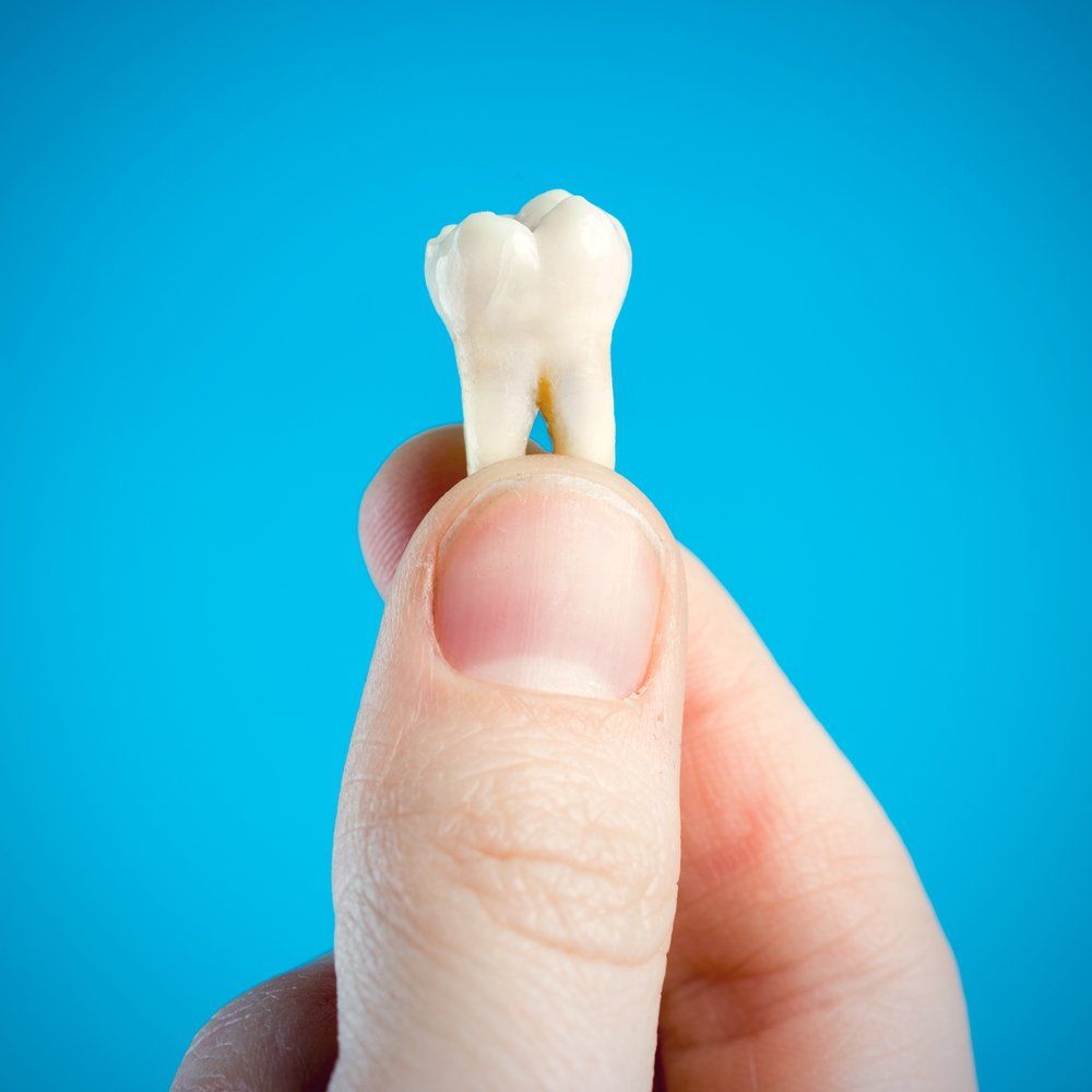 Person Holding Tooth — Dentistry Services in Cairns, QLD