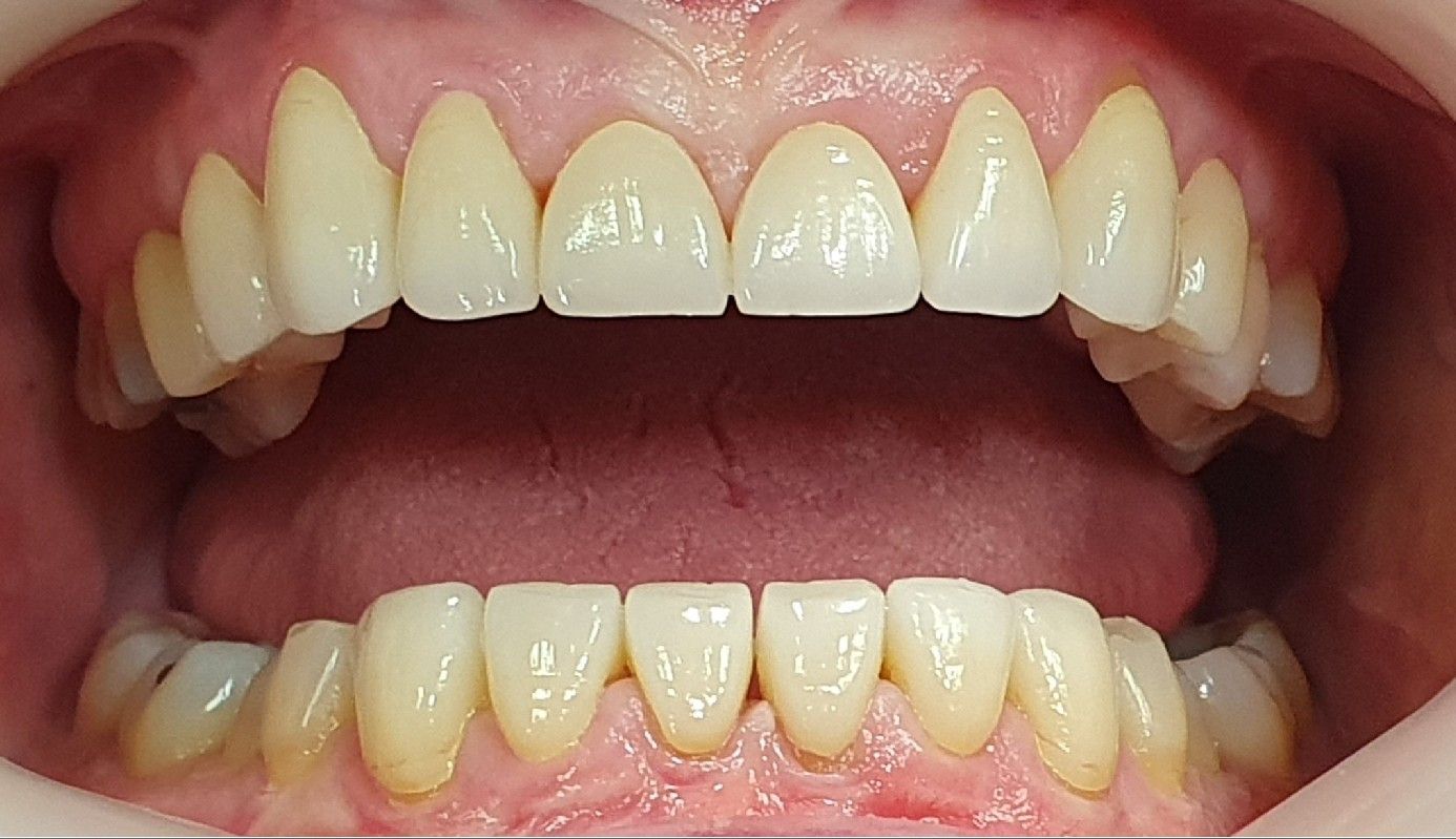 Dental After - The Dentist Cairns Dental Group