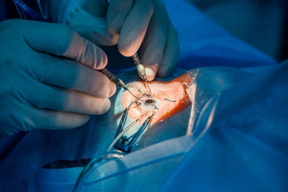 An eye surgeon is operating on a patient in an operating room.