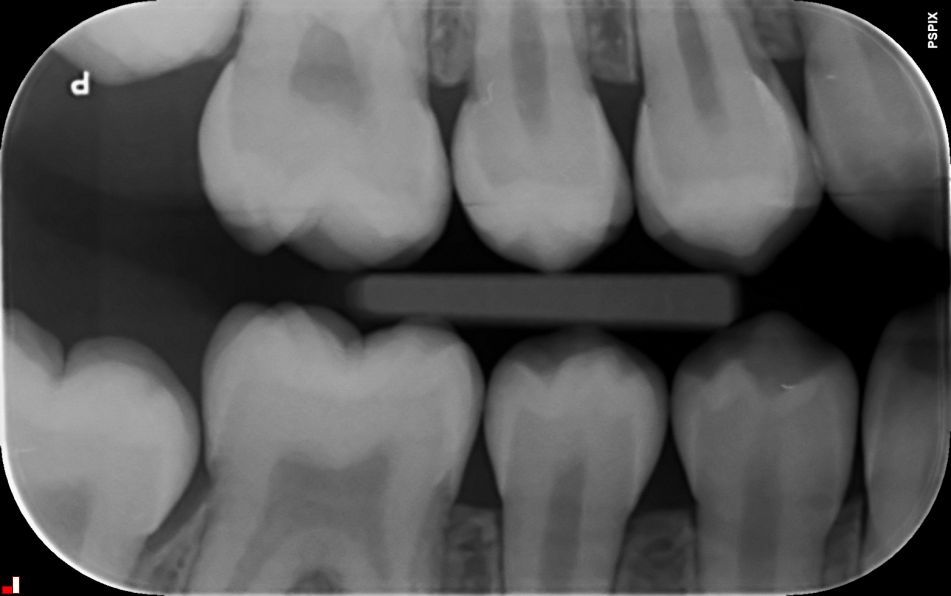 Soins dentaires classiques image