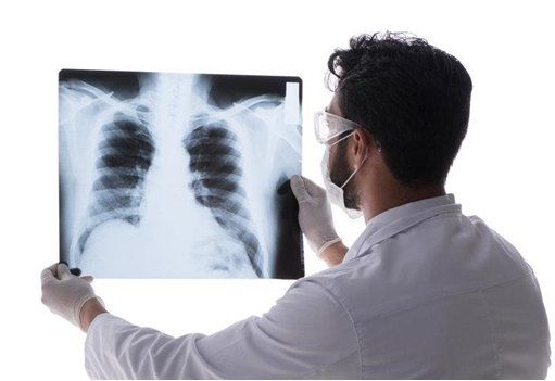 Lung X Ray