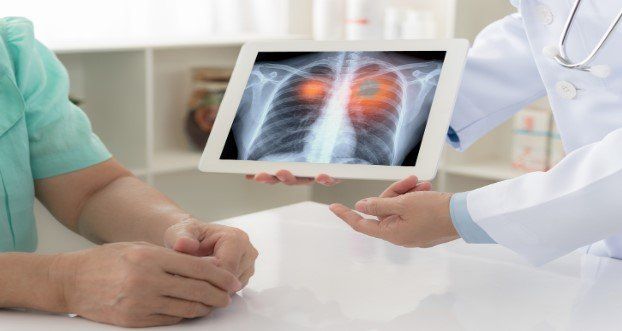 can-you-have-lung-cancer-without-any-symptoms-what-to-look-for