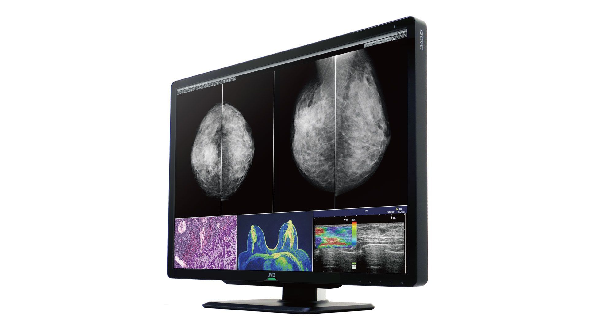 Rentgeno sistemų priedai