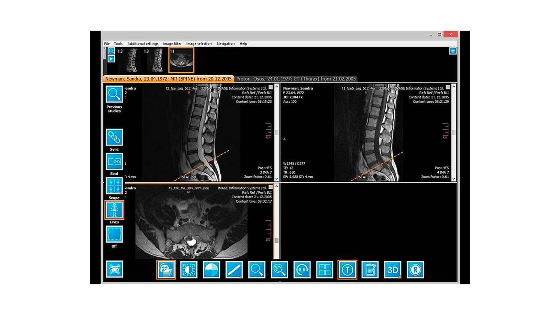 Radiologo darbo vietos įranga