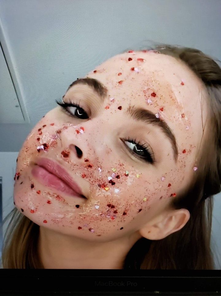 Close-up of a person with a facial treatment mask and red speckles, looking at the camera.