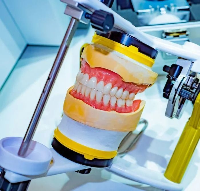 Dental Model With Pink Gums and White Teeth Mounted on a Metal Articulator in a Lab Setting — Smiles On Hobart in Hobart, TAS