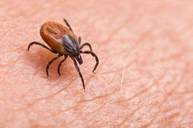 Tick and flea outlet removal