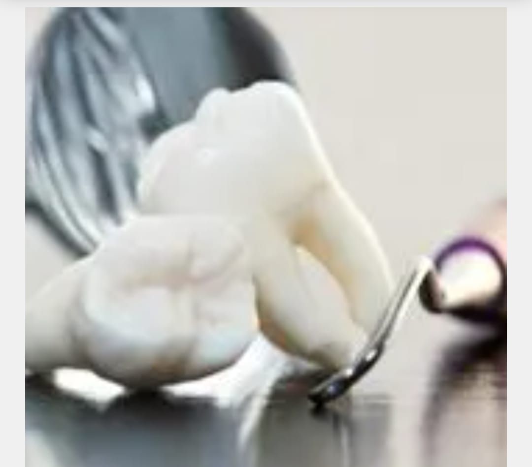 Mano enguantada sosteniendo herramientas dentales, toma de primer plano.