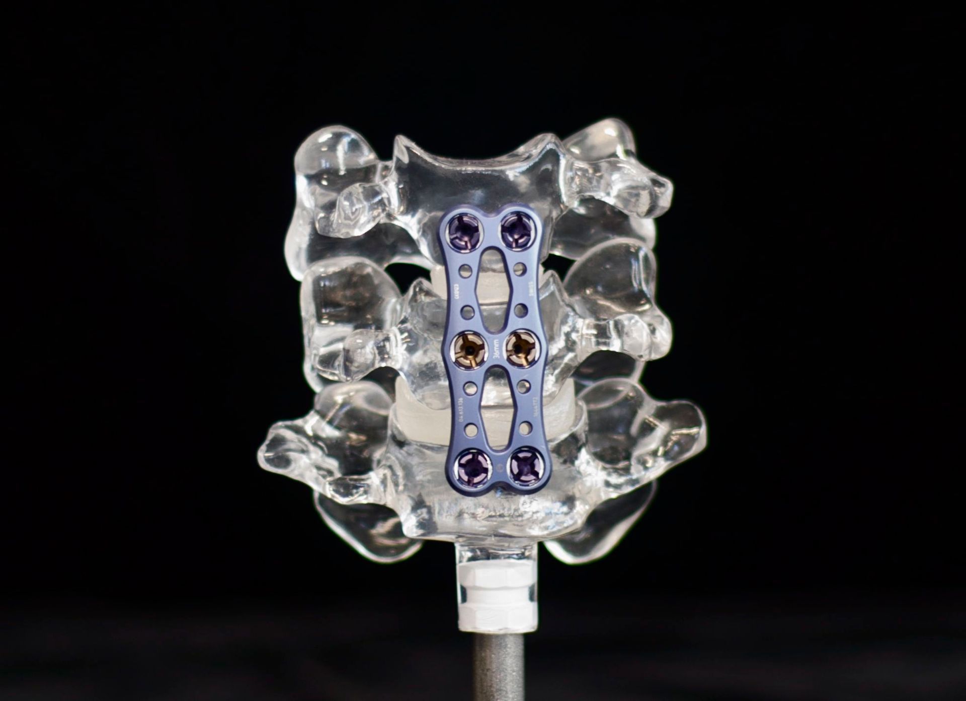 A model of a spine with a metal plate on top of it.