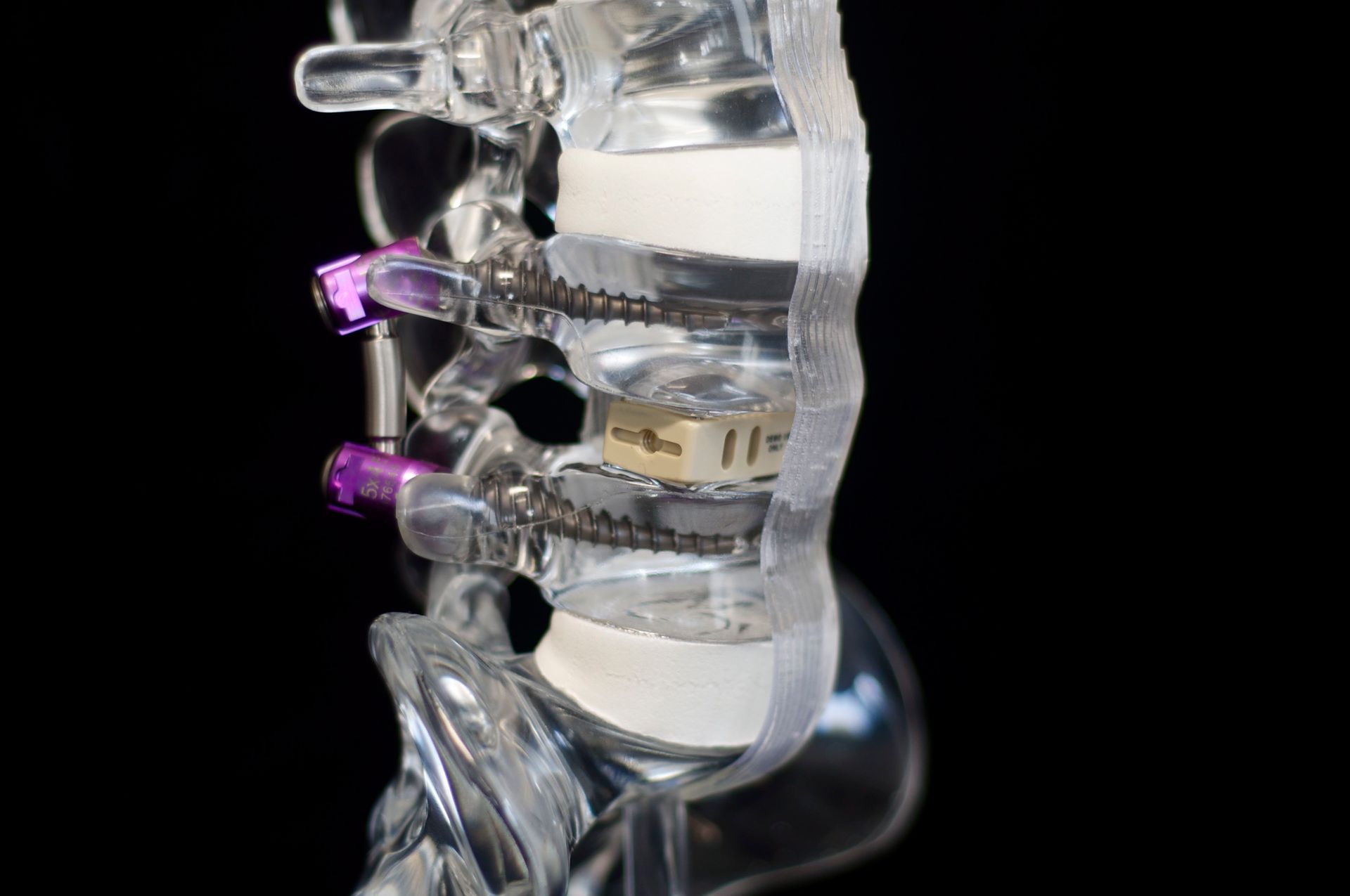 A close up of a model of a spine with a black background.