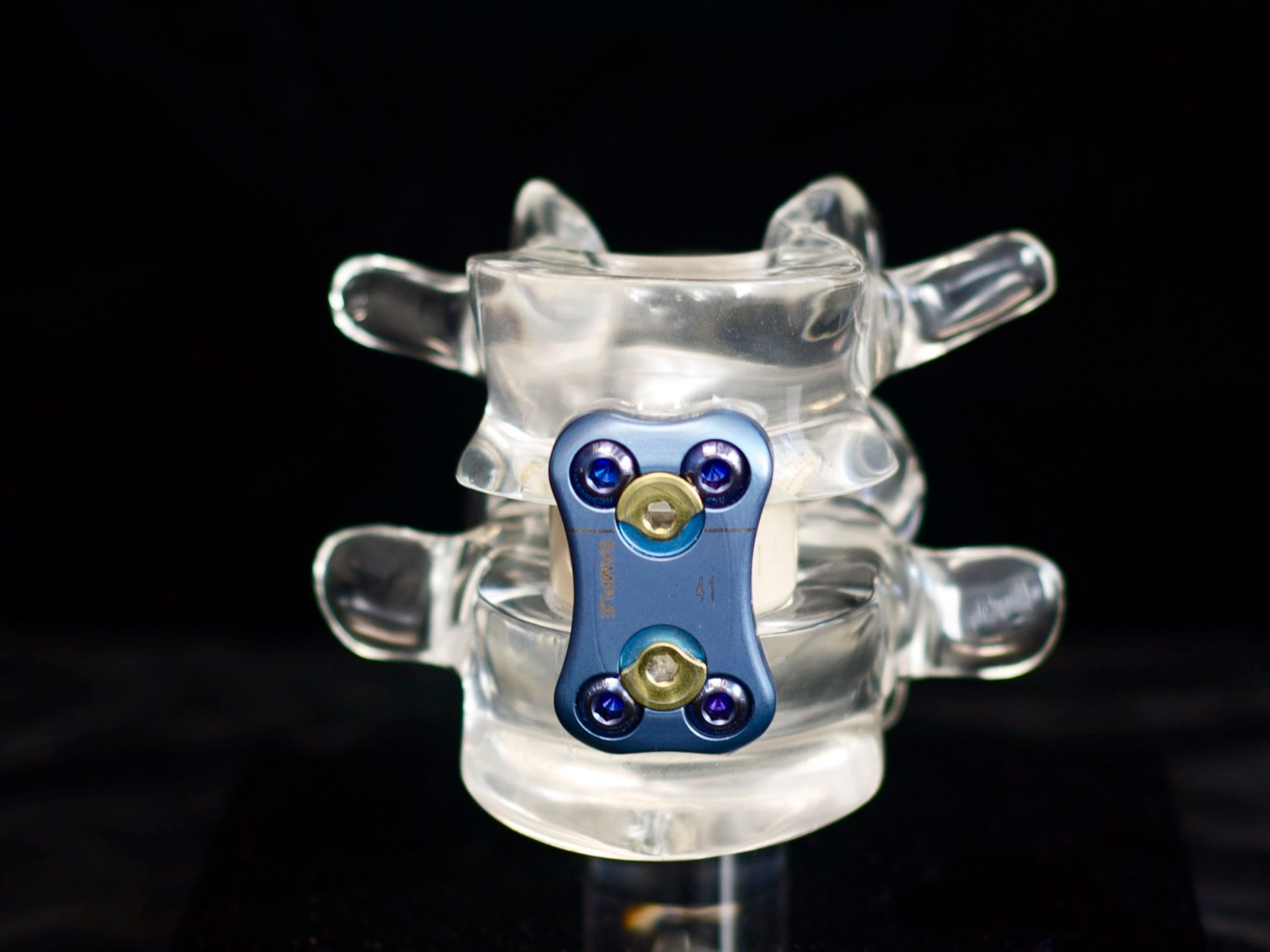 A model of a spine with a metal plate on it