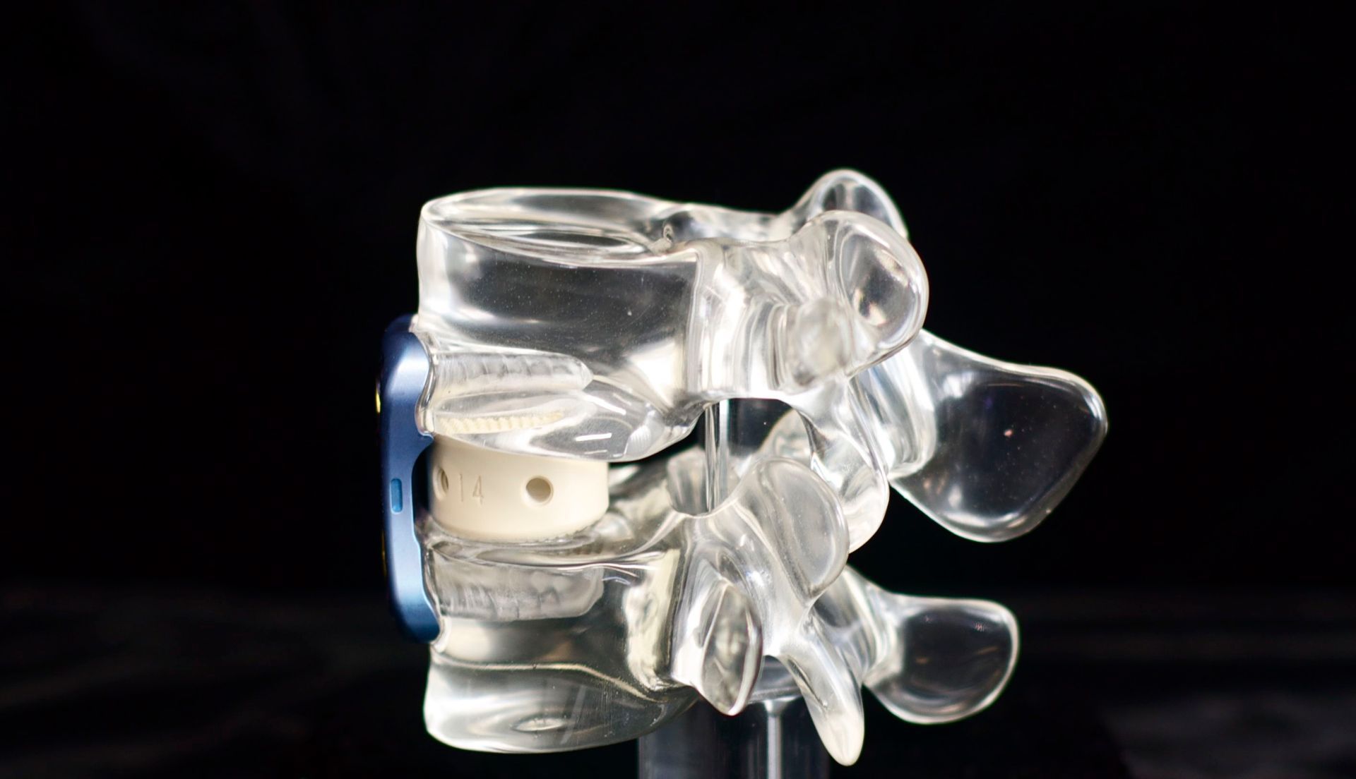 A close up of a model of a human spine on a black background.