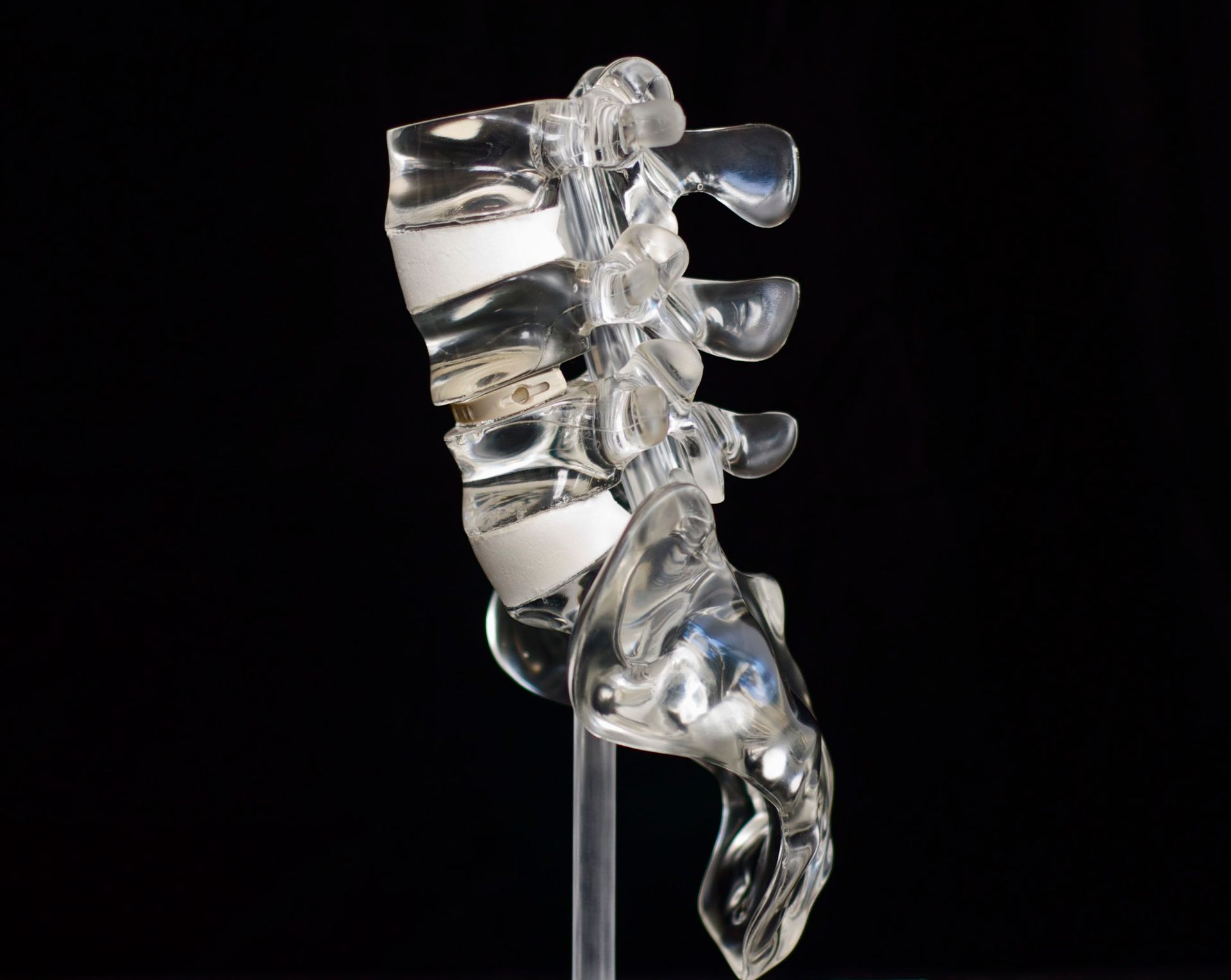 A clear plastic model of a human spine on a black background.
